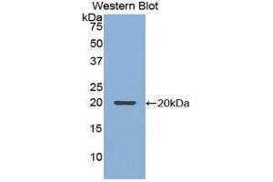Western Blotting (WB) image for anti-Nucleoporin 210kDa (NUP210) (AA 1149-1295) antibody (ABIN1860082) (NUP210 抗体  (AA 1149-1295))