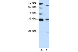 PRDM13 antibody (20R-1222) used at 1. (PRDM13 抗体  (C-Term))