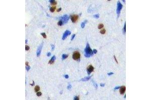 Immunohistochemistry (IHC) image for anti-SRY (Sex Determining Region Y)-Box 2 (SOX2) antibody (ABIN7308362)