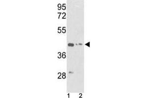 Western blot analysis of g-Actin antibody and (1) K562 and (2) HepG2 lysate (Actin, gamma 1 抗体  (AA 188-215))
