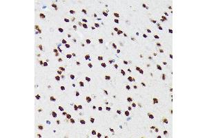 Immunohistochemistry (IHC) image for anti-Polypyrimidine Tract Binding Protein 2 (PTBP2) antibody (ABIN7269465)