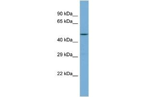 Western Blotting (WB) image for anti-G Protein-Coupled Receptor Kinase 5 (GRK5) (C-Term) antibody (ABIN2785867) (GRK5 抗体  (C-Term))