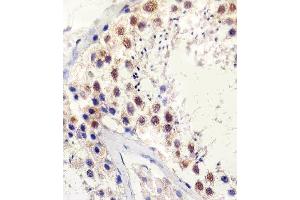 Paraformaldehyde-fixed, paraffin embedded human testis tissue, Antigen retrieval by boiling in sodium citrate buffer (pH6. (TBP 抗体)