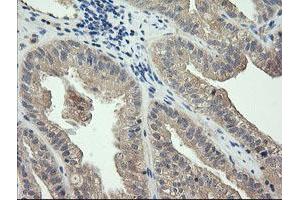 Image no. 2 for anti-Cancer/testis Antigen 1B (CTAG1B) antibody (ABIN1499892) (CTAG1B 抗体)