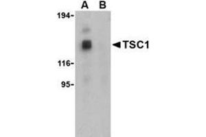 Western blot analysis of TSC1 in EL4 cell lysate with this product at 1 μg/ml in the (A) absence and (B) presence of blocking peptide. (TSC1 抗体  (both Isoforms, Middle Region))