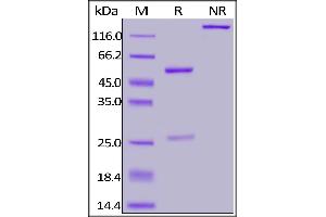 Anti-SARS-CoV-2 Nucleocapsid Antibody, Human IgG1 on SDS-PAGE under reducing (R) condition. (SARS-CoV-2 Nucleocapsid 抗体)