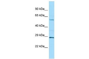WB Suggested Anti-MINPP1 Antibody Titration: 1. (MINPP1 抗体  (C-Term))