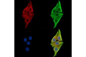 ABIN7097106 and ABIN7101173 staining Hela cells by IF/ICC.