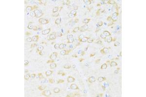 Immunohistochemistry of paraffin-embedded mouse brain using DDX3Y antibody (ABIN6130260, ABIN6139496, ABIN6139497 and ABIN6215395) at dilution of 1:100 (40x lens). (DDX3Y 抗体  (AA 1-210))