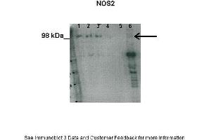 Western Blotting (WB) image for anti-Nitric Oxide Synthase 2, Inducible (NOS2) (N-Term) antibody (ABIN2789330)
