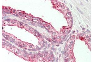 Rabbit Anti-TSPAN1 antibody Catalog Number: ARP43528 Formalin Fixed Paraffin Embedded Tissue: Human Prostate Primary antibody Concentration: 1:100 Secondary Antibody: Donkey anti-Rabbit-Cy3 Secondary Antibody Concentration: 1:200 Magnification: 20x Exposure Time: 0. (TSPAN1 抗体  (Middle Region))