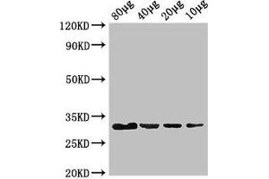 Western Blot Positive WB detected in: Rosseta bacteria lysate at 80 μg, 40 μg, 20 μg, 10 μg All lanes: eutC antibody at 3 μg/mL Secondary Goat polyclonal to rabbit IgG at 1/50000 dilution predicted band size: 32 kDa observed band size: 32 kDa (EUTC (AA 1-295) 抗体)