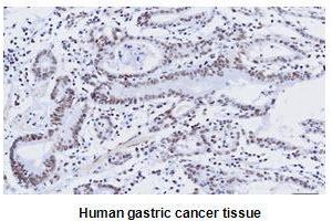 Immunohistochemistry (IHC) image for anti-Kruppel-Like Factor 4 (Gut) (KLF4) (AA 1-170), (N-Term) antibody (ABIN336104)