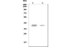 Western blot analysis of CCR5 using anti-CCR5 antibody (ABIN7600612).
