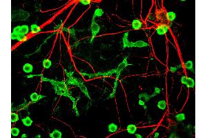 Mixed neuron glia cultures stain with INA antibody (red) and counterstained with rabbit polyclonal antibody to Coronin 1a, (green) which is an excellent marker of microglia and lymphocytes. (INA 抗体)