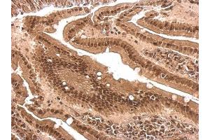 Immunohistochemistry (IHC) image for anti-Poly(rC) Binding Protein 2 (PCBP2) antibody (ABIN2856965)
