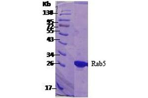SDS-PAGE of 26 kDa human Rab5 protein (ABIN1686702, ABIN1686703 and ABIN1686704). (RAB5 Protein (His tag))