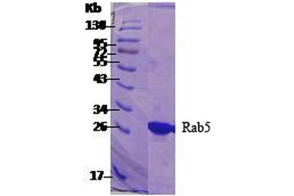 RAB5 Protein (His tag)