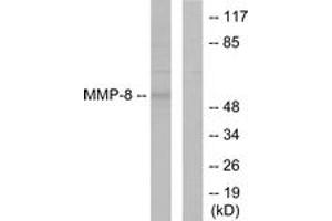 Western blot analysis of extracts from NIH-3T3 cells, using MMP-8 Antibody. (MMP8 抗体  (AA 418-467))