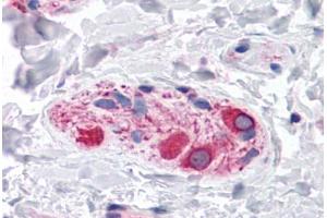 Human Colon, Submucosal Plexus: Formalin-Fixed, Paraffin-Embedded (FFPE) (BOK 抗体  (C-Term))