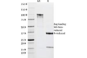 SDS-PAGE Analysis Purified HLA-DRA Mouse Monoclonal Antibody (IPO-10). (HLA-DRA 抗体)
