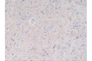 IHC-P analysis of Human Brain Tissue, with DAB staining. (MBP 抗体  (AA 135-190))