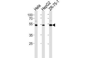 Western Blotting (WB) image for anti-Telomeric Repeat Binding Factor 2, Interacting Protein (TERF2IP) antibody (ABIN2997696) (RAP1 抗体)