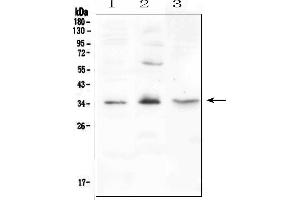 Western blot analysis of FGF23 using anti-FGF23 antibody (ABIN6719316).
