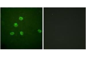 Immunofluorescence analysis of HepG2 cells, using FosB (Ab-27) Antibody. (FOSB 抗体  (AA 12-61))