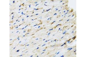 Immunohistochemistry of paraffin-embedded Rat heart using RAF1 Polyclonal Antibody at dilution of 1:100 (40x lens). (RAF1 抗体)
