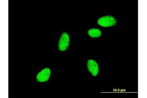 Immunofluorescence of monoclonal antibody to NEUROG2 on HeLa cell. (Neurogenin 2 抗体  (AA 36-112))
