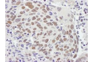 Immunohistochemistry (IHC) image for anti-Mismatch Repair Protein 2 (MSH2) (C-Term) antibody (ABIN7453440)