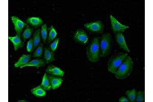 Immunofluorescent analysis of A549 cells using ABIN7145535 at dilution of 1:100 and Alexa Fluor 488-congugated AffiniPure Goat Anti-Rabbit IgG(H+L) (BACE2 抗体  (AA 84-157))