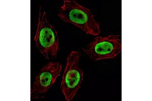 Fluorescent image of  cell stained with EZH2 Antibody (ABIN659002 and ABIN2838040) / SG100830. (EZH2 抗体)