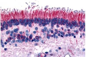 Immunohistochemistry (IHC) image for anti-Protein Tyrosine Phosphatase, Receptor Type, M (PTPRM) (Internal Region) antibody (ABIN1049278)