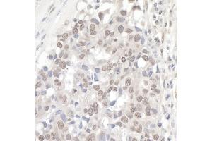 anti-Nuclear Cap Binding Protein Subunit 1, 80kDa (NCBP1) (AA 482-532) antibody