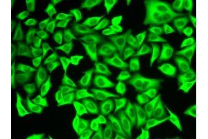 Immunofluorescence analysis of A549 cells using ALDH4A1 antibody. (ALDH4A1 抗体  (AA 354-563))