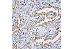 IHC analysis of CETP using anti-CETP antibody (ABIN7602439). (CETP 抗体  (AA 77-353))