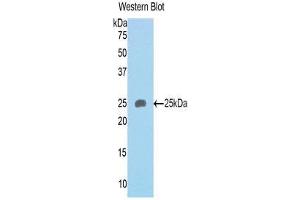 Western Blotting (WB) image for anti-Sema Domain, Immunoglobulin Domain (Ig), Transmembrane Domain (TM) and Short Cytoplasmic Domain, (Semaphorin) 4B (SEMA4B) (AA 31-240) antibody (ABIN1171802) (SEMA4B 抗体  (AA 31-240))