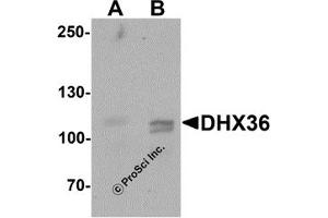 Western Blotting (WB) image for anti-DEAH (Asp-Glu-Ala-His) Box Polypeptide 36 (DHX36) (C-Term) antibody (ABIN1077418) (DHX36 抗体  (C-Term))