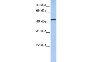 TRMT11 antibody used at 1 ug/ml to detect target protein. (Trmt11 抗体)