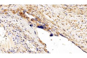 Detection of gp130 in Human Placenta Tissue using Polyclonal Antibody to Glycoprotein 130 (gp130)
