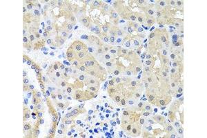 Immunohistochemistry of paraffin-embedded Mouse kidney using BSND Polyclonal Antibody at dilution of 1:100 (40x lens). (BSND 抗体)