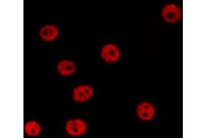 ABIN6267529 staining 293 by IF/ICC. (SAPK, JNK (pTyr185) 抗体)