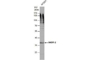 WB Image NHERF-2 antibody detects NHERF-2 protein by western blot analysis. (SLC9A3R2 抗体  (Center))