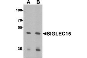 Western blot analysis of SIGLEC15 in Rat kidney tissue lysate with SIGLEC15 antibody at (A) 1 and (B) 2 ug/mL