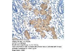 Rabbit Anti-DAZ4 Antibody  Paraffin Embedded Tissue: Human Kidney Cellular Data: Epithelial cells of renal tubule Antibody Concentration: 4. (DAZ4 抗体  (N-Term))
