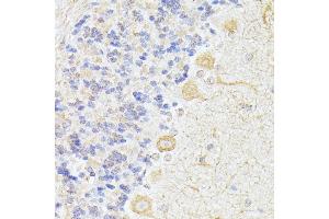 Immunohistochemistry of paraffin-embedded rat cerebellum using K/K/Elp3 antibody (ABIN6130883, ABIN6140142, ABIN6140143 and ABIN6225217) at dilution of 1:100 (40x lens). (ELP3/KAT9 抗体  (AA 358-547))