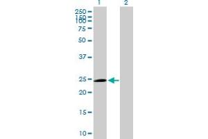 Western Blot analysis of TRIM50C expression in transfected 293T cell line by TRIM50C MaxPab polyclonal antibody. (TRIM74 抗体  (AA 1-249))