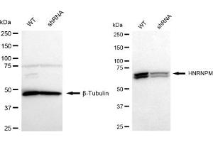Western blotting analysis using HNRNPM antibody (ABIN7798901). (Recombinant HNRNPM 抗体)